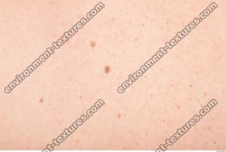 photo texture of white skin 0021